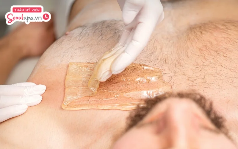 Thực hiện wax lông sai cách có thể tiềm ẩn nhiều nguy cơ đau rát, khó chịu và gia tăng nguy cơ viêm nang lông