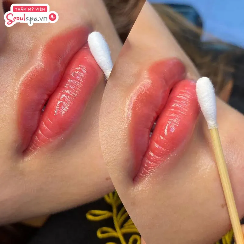 Vệ sinh môi đúng cách và nhẹ nhàng sau phun môi là cách giúp hạn chế rủi ro viêm nhiễm ngoài ý muốn