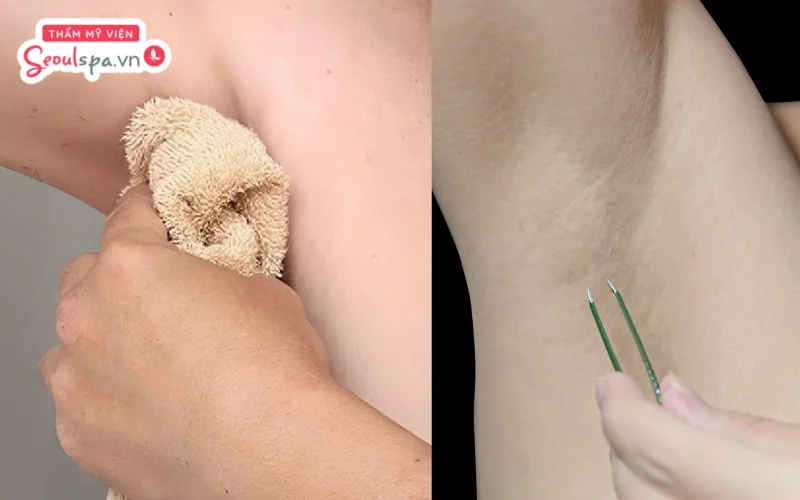 Thực hiện làm mềm vùng da dưới cánh tay bằng khăn ấm trước khi nhổ để hạn chế nguy cơ đau rát ngoài ý muốn