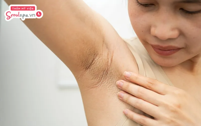 Tránh áp dụng cách tẩy lông nách bằng chanh quá thường xuyên vì dễ khiến da khô ráp và gia tăng nguy cơ kích ứng