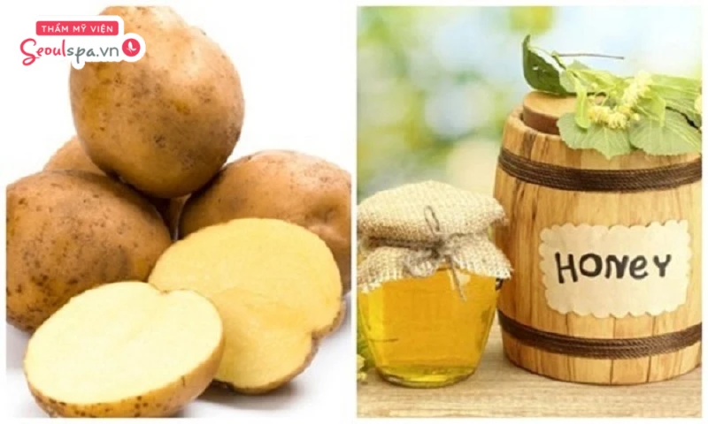Triệt lông nách tại nhà cũng không thể bỏ qua công thức mật ong và khoai tây