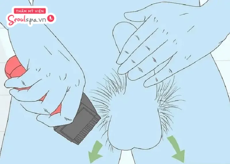 Tỉa lông vùng kín nam bằng tông đơ là cách thông dụng nhất, an toàn và nhanh chóng nhất