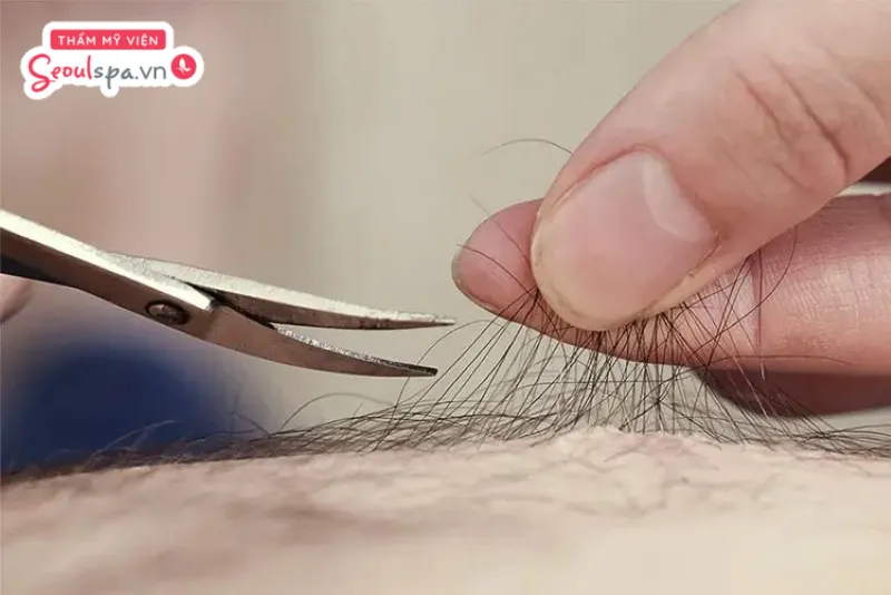 Tỉa lông vùng kín gọn gàng bằng kéo đúng cách để ngăn ngừa rủi ro trầy xước và kích ứng da không mong muốn