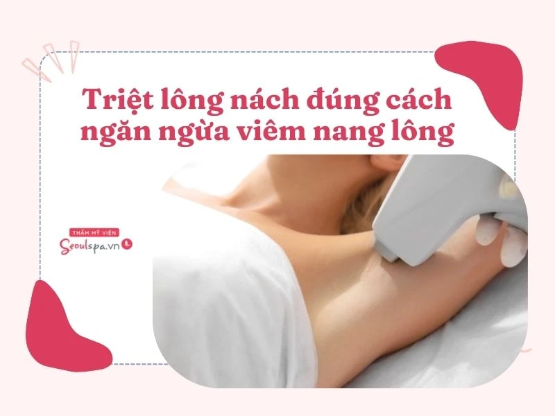 Triệt lông nách vĩnh viễn mang lại nhiều hiệu quả lâu dài giúp hạn chế mùi cơ thể và ngăn ngừa nguy cơ viêm nang lông
