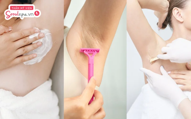 Cạo, nhổ và wax lông nách tại nhà là một số cách loại bỏ lông thông dụng nhưng cũng tiềm ẩn nhiều rủi ro