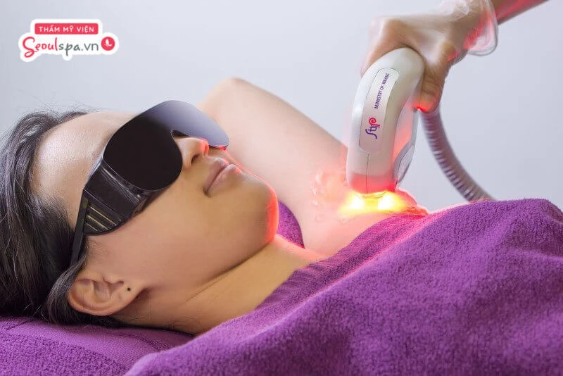 Thẩm mỹ viện SeoulSpa.Vn là địa chỉ triệt lông nách uy tín ứng dụng đa dạng công nghệ triệt lông hiện đại