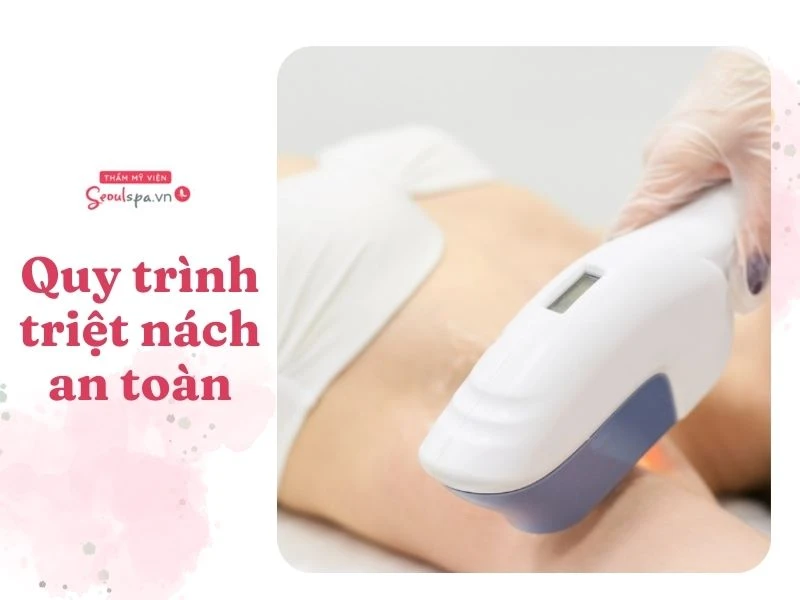 Thực hiện quy trình triệt lông đúng cách sẽ giúp bạn đạt được hiệu quả loại bỏ lông tối ưu và nhanh chóng