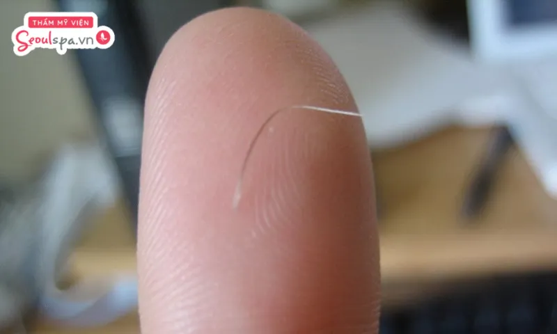 Lông mũi trắng có thể là dấu hiệu sức khỏe đang "đi xuống"