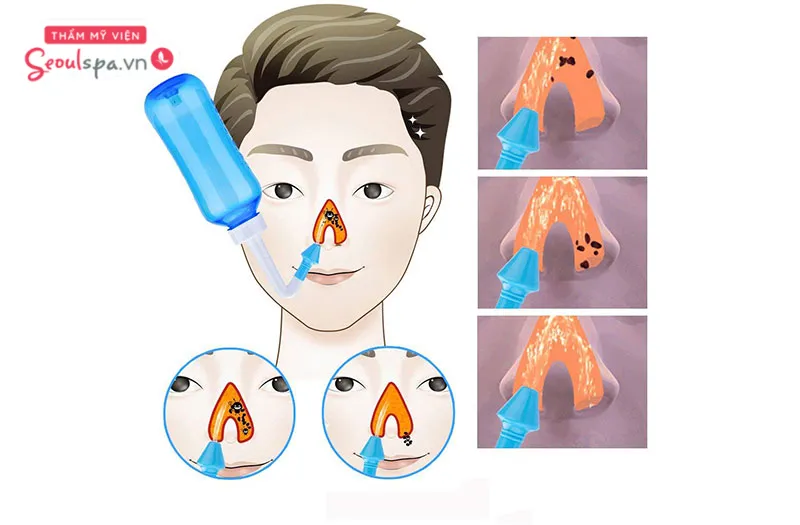 Vệ sinh khoang mũi sạch sẽ, hỗ trợ lông mũi mọc đen trở lại