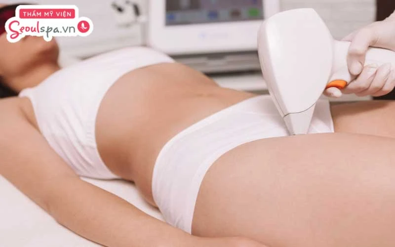 Triệt lông bikini sử dụng ánh sáng với mức năng lượng phù hợp để tác động sâu vào nang lông, từ đó làm rụng lông hiệu quả