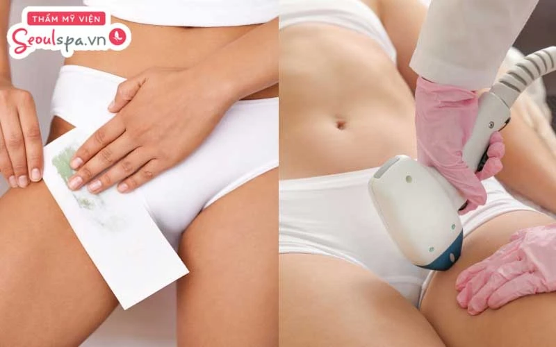 Nên wax lông hay triệt lông vùng kín còn tùy thuộc vào nhu cầu cũng như ngưỡng chịu đau của từng người