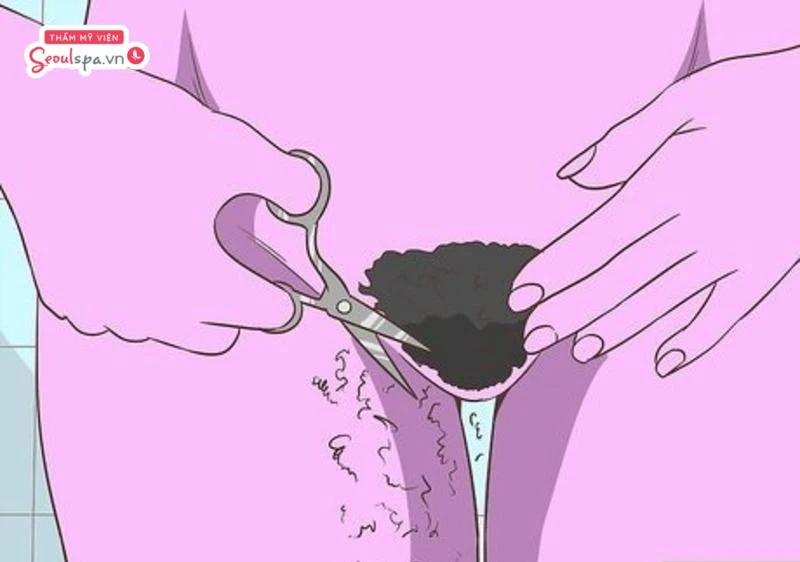 Không vệ sinh và cắt tỉa lông vùng kín đúng cách có thể dễ khiến lông mọc lại lởm chởm và gia tăng nguy cơ viêm ngứa