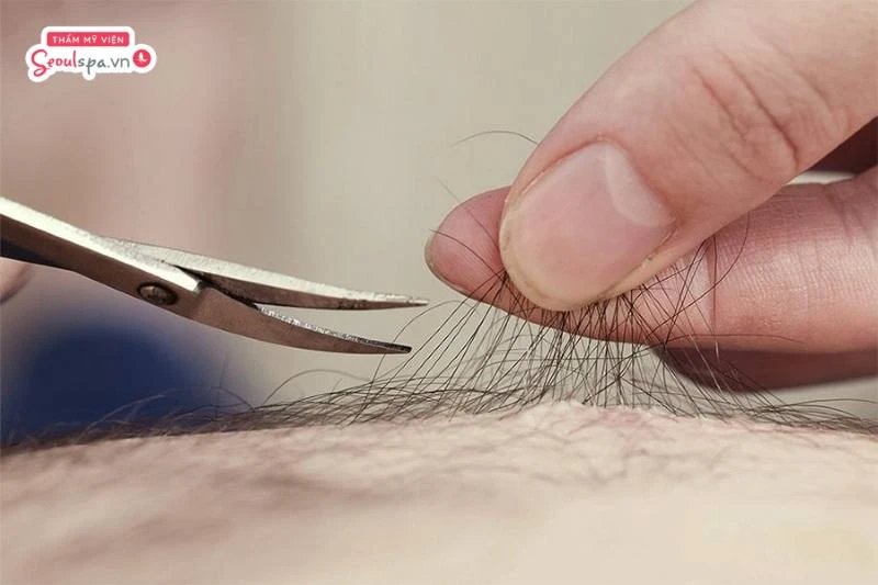 Cắt tỉa lông vùng kín giúp gia tăng tính thẩm mỹ và hạn chế nguy cơ viêm nhiễm khi lông mọc quá rậm rạp
