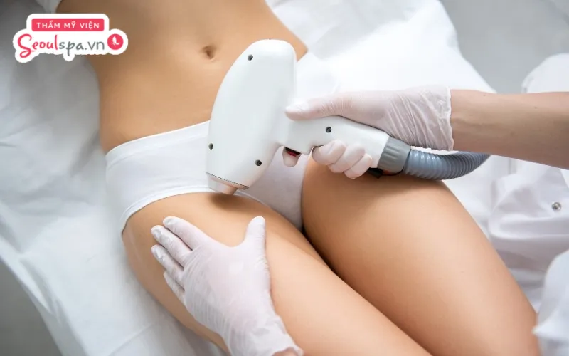 Thực hiện triệt lông vùng kín với tần suất quá thường xuyên có thể là nguyên nhân khiến vùng kín dễ kích ứng