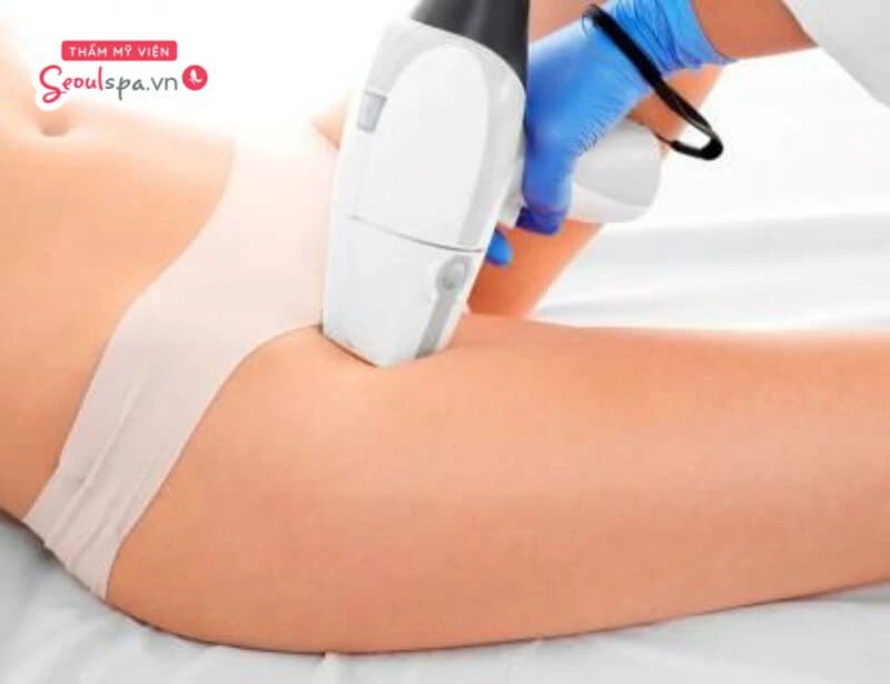 Triệt lông bikini có thể tiềm ẩn các tác dụng phụ nếu không được thực hiện đúng cách