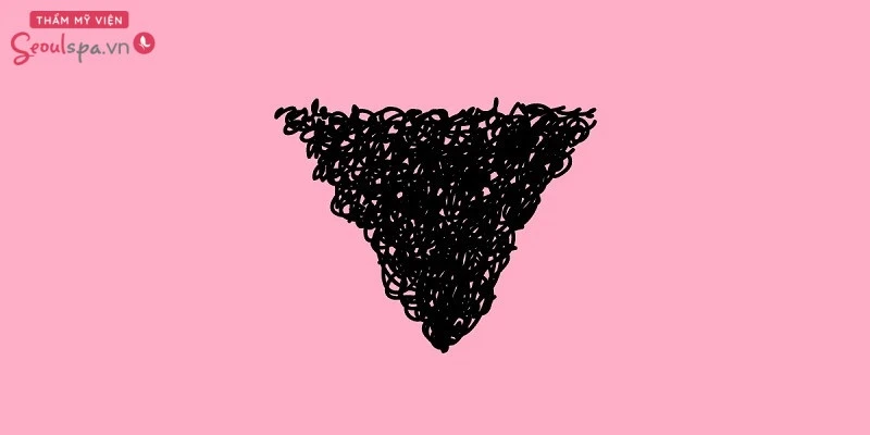 Lựa chọn triệt lông tạo hình tam giác cuốn hút và độc đáo