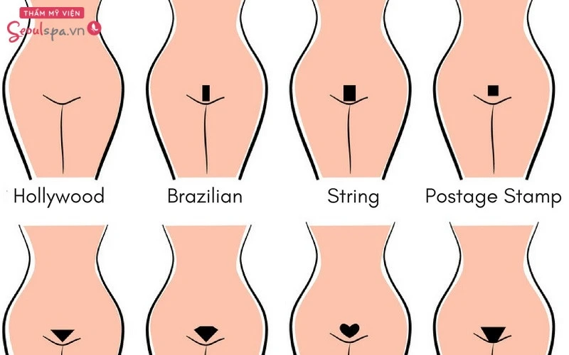 Tạo hình lông bikini kiểu pháp ấn tượng và khác biệt