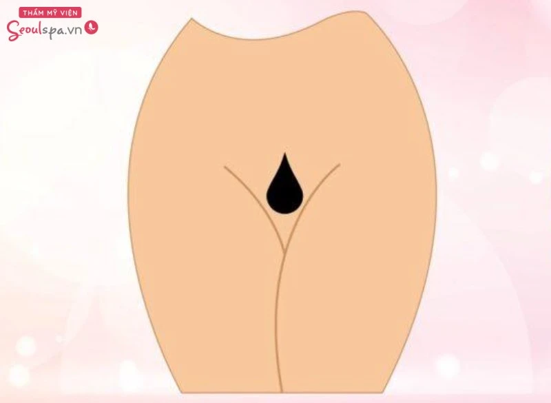 Lựa chọn triệt lông bikini hình giọt nước tỉ mỉ