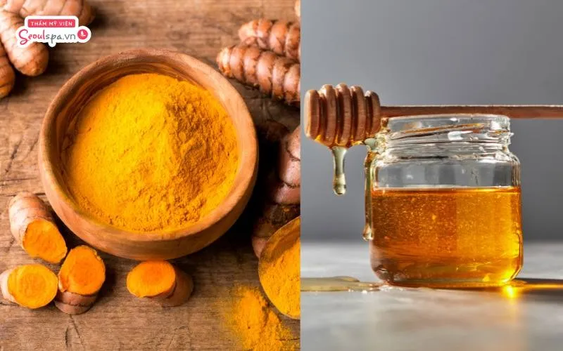 Hỗn hợp mật ong và tinh bột nghệ không chỉ giúp loại bỏ lông mà còn ngăn ngừa nguy cơ viêm nang lông hiệu quả