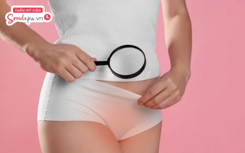 Triệt lông hậu môn sai cách có thể tiềm ẩn rủi ro châm chích, ngứa ngáy và viêm nhiễm không mong muốn