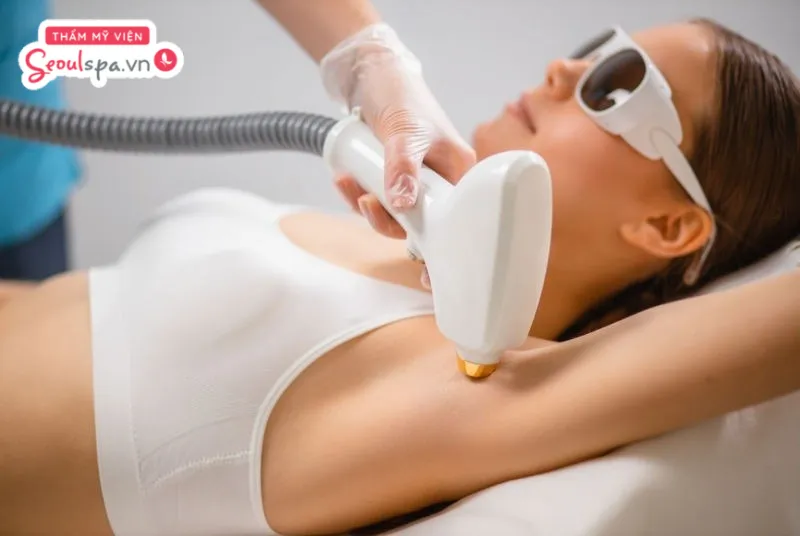 Triệt lông nách bằng công nghệ cao giúp đem lại hiệu quả triệt lông lâu dài và giảm mùi hôi nách hiệu quả