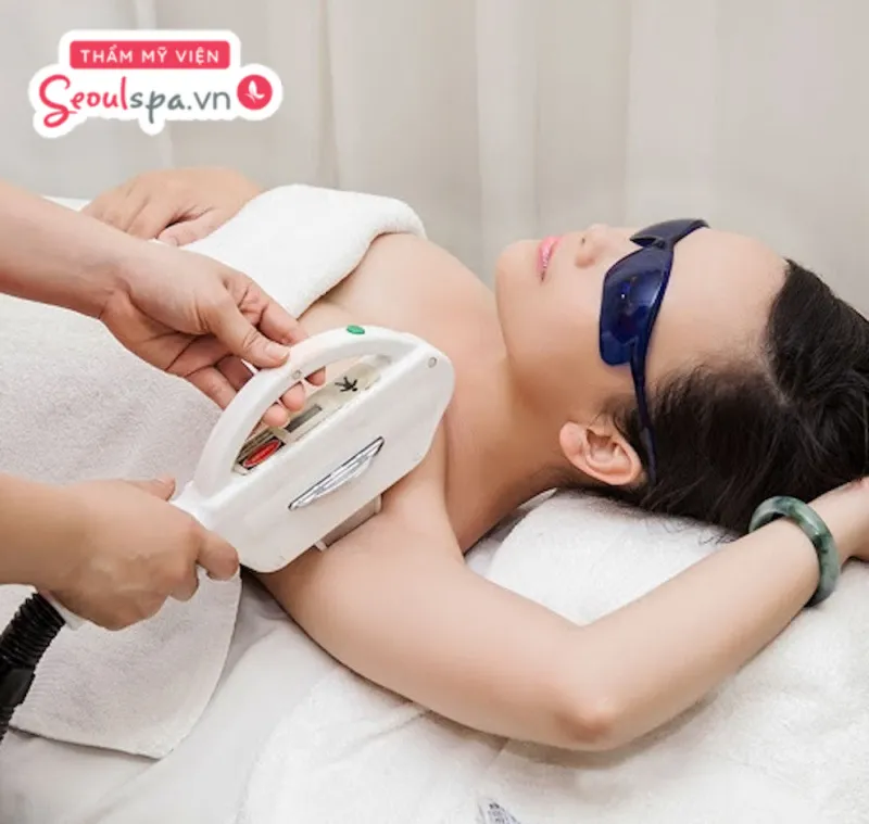 Triệt lông tại Thẩm mỹ viện SeoulSpa.Vn giúp làn da láng mịn