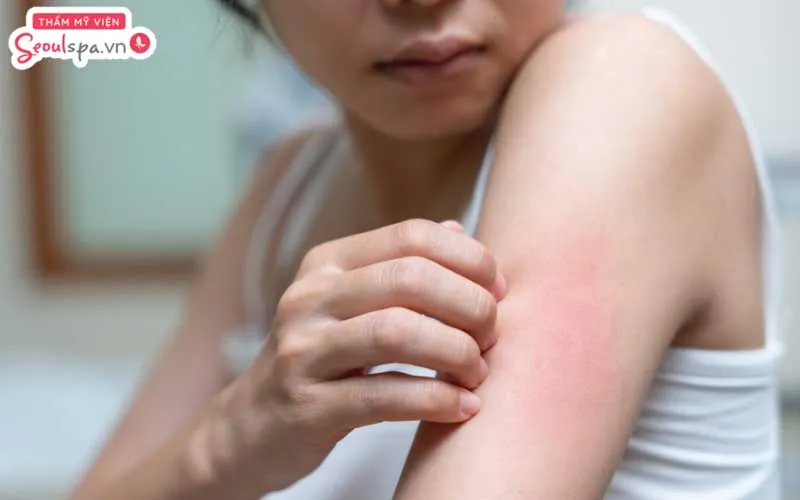 Thực hiện triệt lông theo cách người dao đỏ có thể tiềm ẩn nguy cơ gây đỏ rát, viêm nhiễm với người có làn da quá nhạy cảm