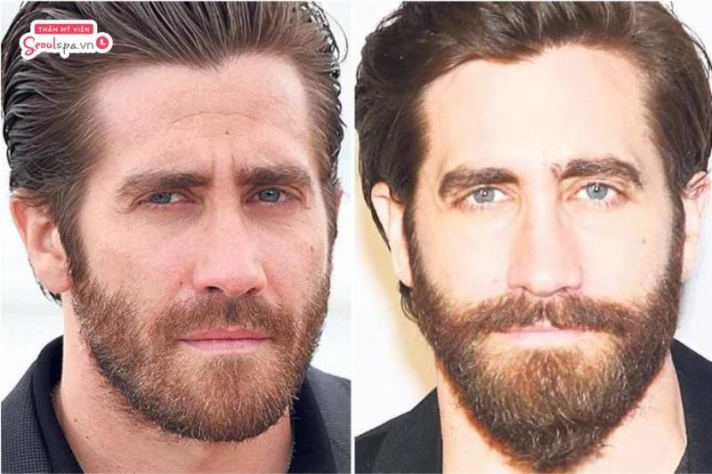 Jake Gyllenhaal