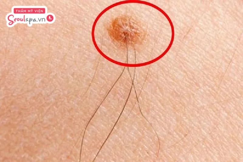 Lông tài thường mang lại ý nghĩa tướng số tốt đẹp cho người sở hữu, dưới góc độ y khoa nó cũng không ảnh hưởng đến sức khỏe