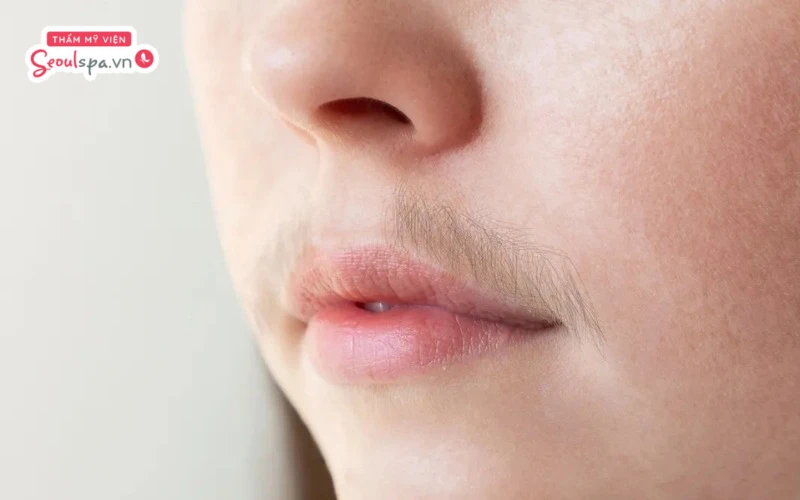Lông trắng mọc thành cụm và từng chùm trên mắt được cho là điềm báo may mắn về tài lộc và phong thủy