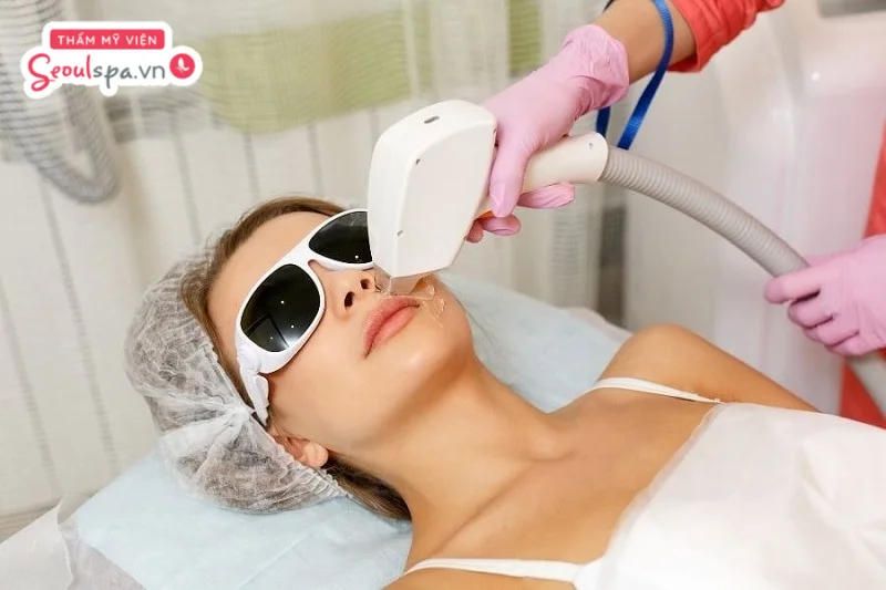 Triệt lông bằng công nghệ hiện đại là giải pháp loại bỏ lông trắng ở mặt hoàn toàn hiệu quả, an toàn