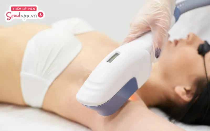 Triệt lông công nghệ cao tại spa đem đến quy trình triệt chuyên nghiệp hơn và phù hợp với nhiều vùng da khác nhau