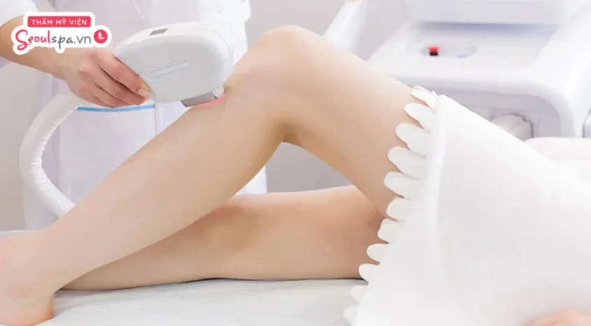 IPL là công nghệ triệt lông hiện đại được ứng dụng phổ biến tại các spa và thẩm mỹ viện với khả năng loại bỏ lông diện rộng
