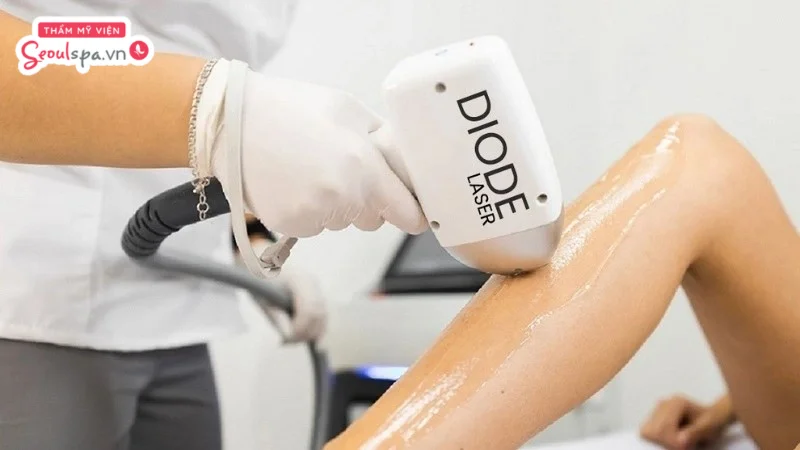 Diode Laser là công nghệ triệt lông tiến tiến sử dụng ánh sáng đơn sắc tích hợp đầu làm mát để giảm thiểu nguy cơ bỏng rát