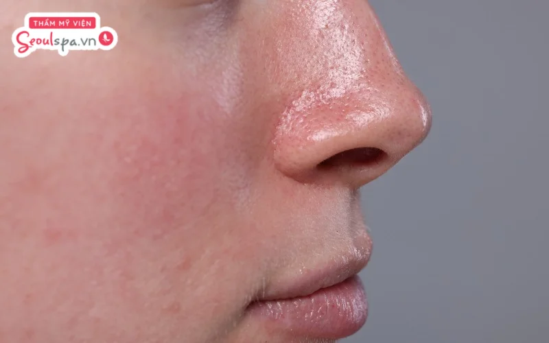 Công nghệ IPL nếu sử dụng trên da mặt hoặc vùng da quá nhạy cảm có thể tiềm ẩn rủi ro kích ứng, đỏ rát