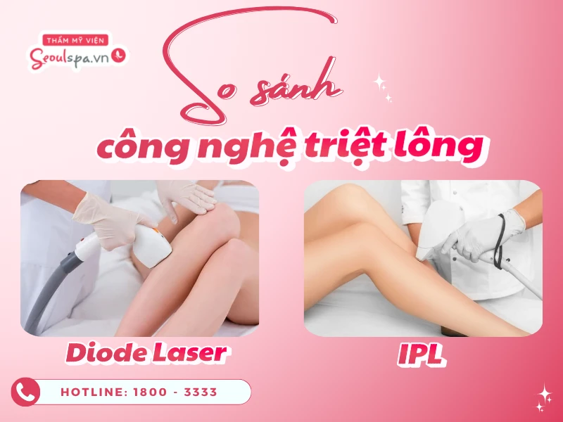 So sánh công nghệ triệt lông Diode Laser và IPL