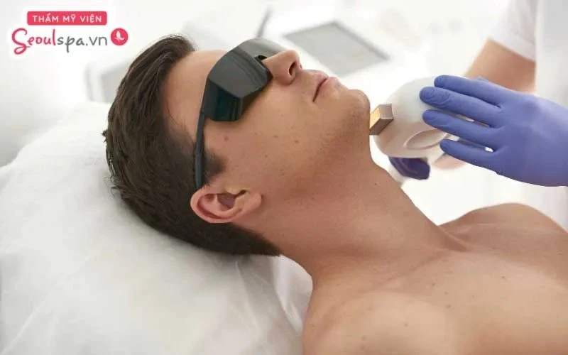 Triệt lông mặt bằng công nghệ hiện đại là phương pháp loại bỏ sạch lông hiệu quả, ức chế lông mọc lại trong thời gian dài