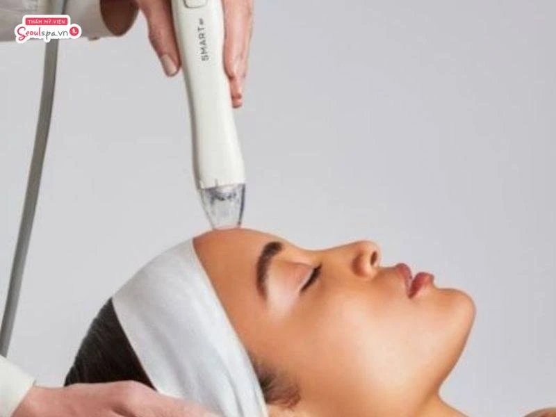 Triệt chân tóc trán cần đảm bảo đúng quy trình thì mới hiệu quả