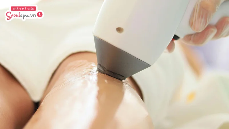 Bạn cần điều chỉnh cường độ ánh sáng của máy triệt phù hợp để tránh bỏng
