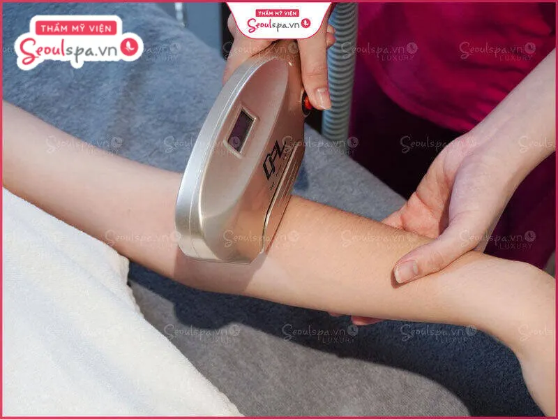 Thẩm mỹ viện SeoulSpa.Vn – Địa điểm triệt lông tay an toàn