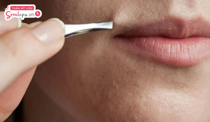 Nhổ râu tiện lợi, chi phí thấp nhưng có thể tiềm ẩn nhiều tác hại cho làn da