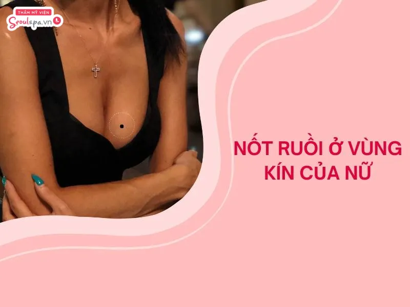 Phụ nữ có nốt ruồi ở vùng kín là tuýp người quyến rũ