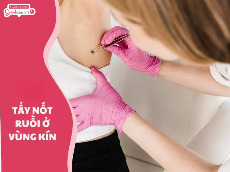 Tẩy nốt ruồi ở vùng kín cần lựa chọn địa chỉ uy tín, an toàn và đảm bảo tính riêng tư