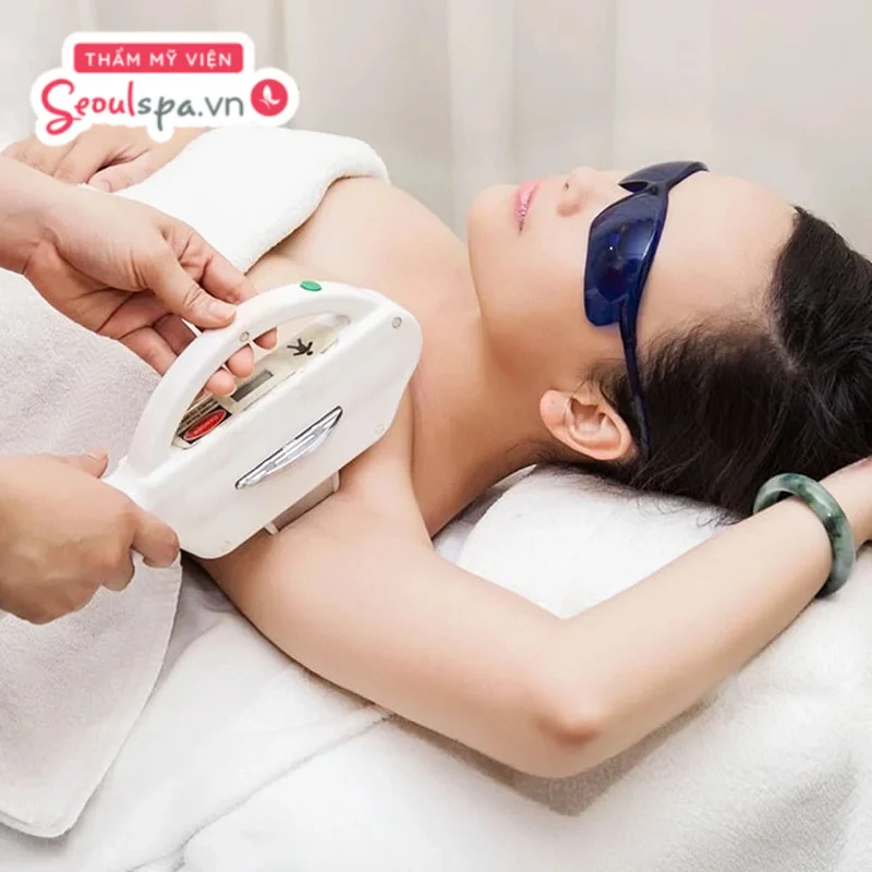 Bạn cần tuân thủ liệu trình triệt lông để đạt hiệu quả tốt
