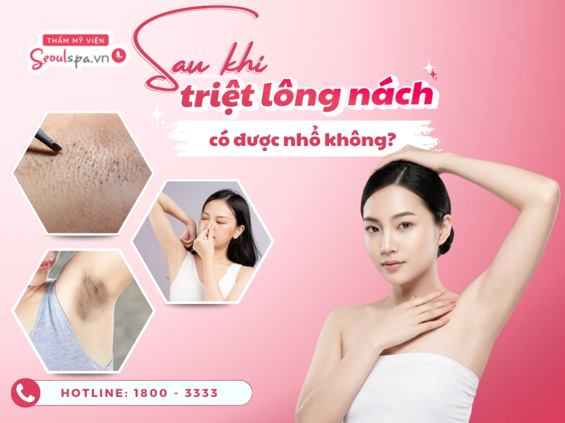 Triệt lông nách có được nhổ không