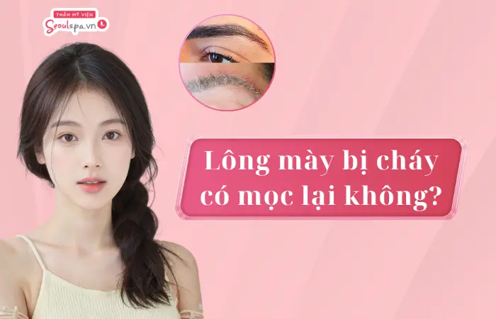 Lông mày bị cháy có mọc lại không? Cách phục hồi hiệu quả