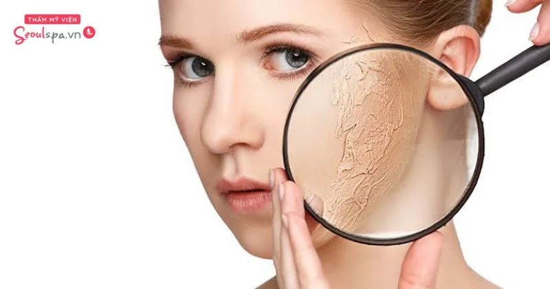 Cần dưỡng ẩm kỹ sau khi triệt để tránh tình trạng da bị khô và bong tróc.