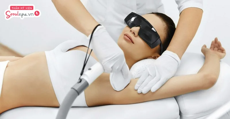 Công nghệ triệt lông Laser Diode có tác dụng triệt tận gốc nang lông, làm mịn da, sáng da mẹ bỉm