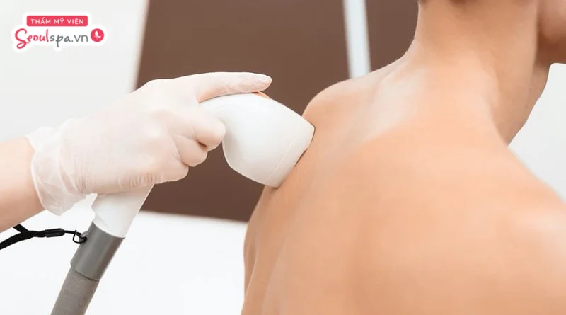 Sử dụng công nghệ hiện đại triệt lông măng nhanh chóng và an toàn