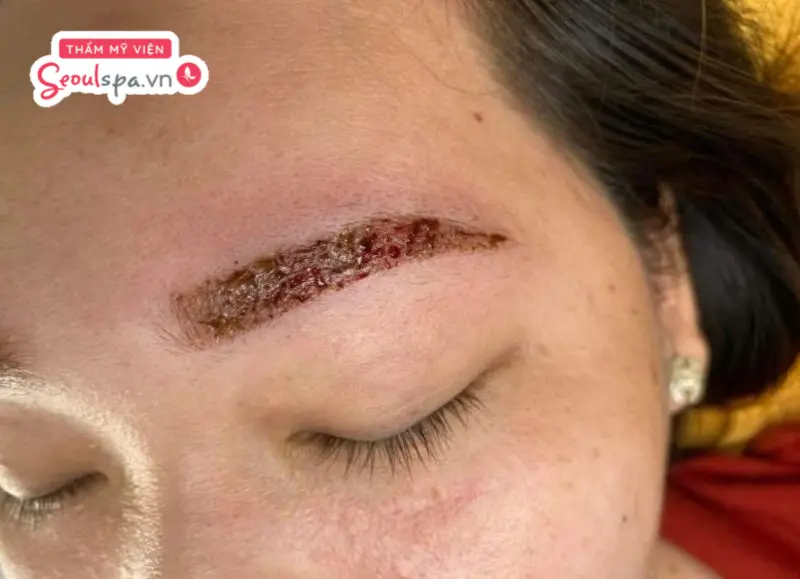 Nước bẩn có thể làm tăng nguy cơ viêm nhiễm và ảnh hưởng đến quá trình hồi phục của chân mày sau phun xăm.